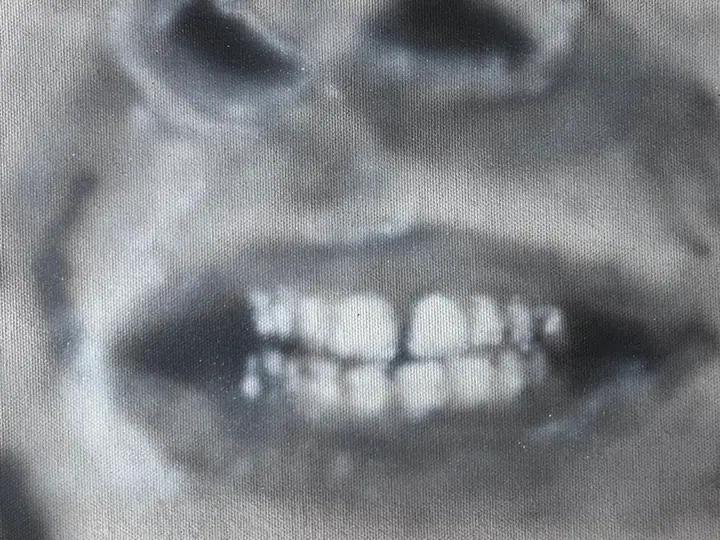 Teeth by Folke Ignestam